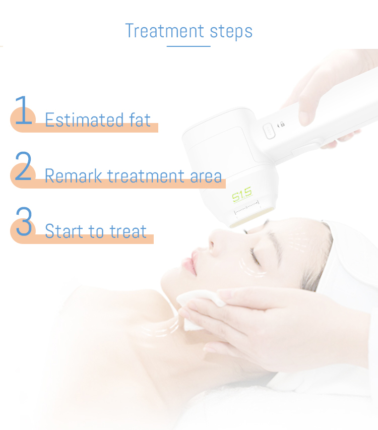 Hifu Device Mini Face Cheek Scarless Thigh Lift from China manufacturer